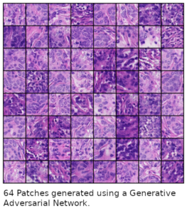 64 patches generated using generative deep learning