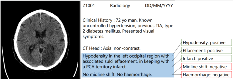 Example radiology report