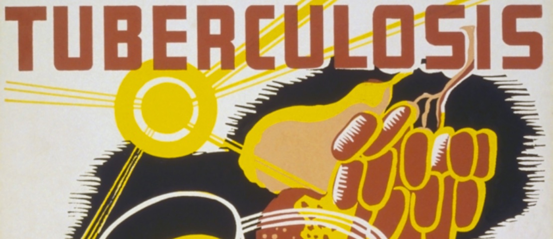 A piece of public health art to promote awareness of the fight against tuberculosis