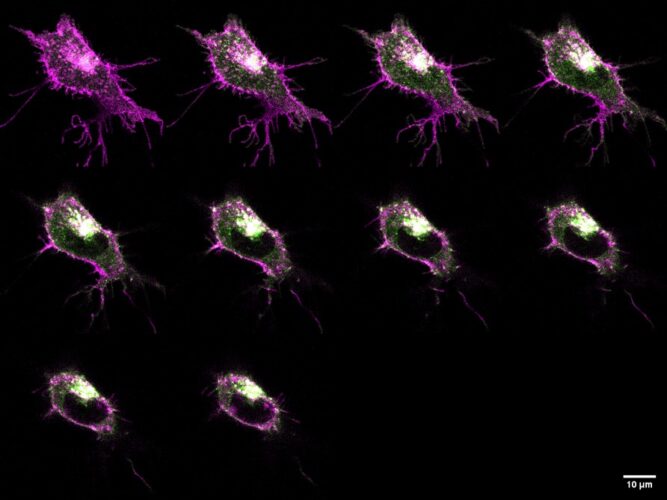 Key mechanism in appetite and weight control uncovered