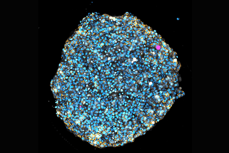 &lsquo;Squishy&rsquo; lasers could reveal how tumours and babies grow