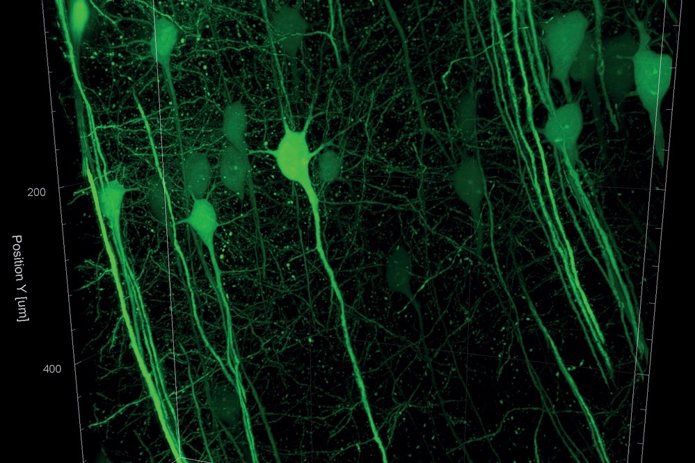 Lit up brain cells in a light sheet.