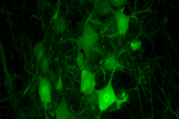 an image from a microscope showing neurons fluorescing