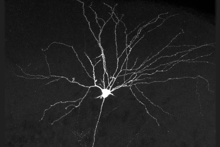 Alzheimer's memory discovery