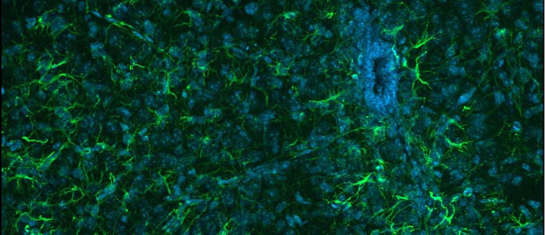 Microscope image of neurons